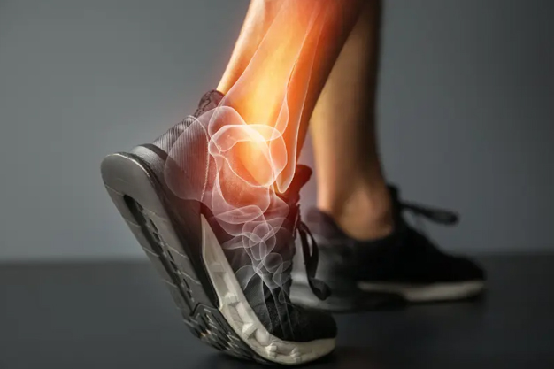 Ankle-sprain