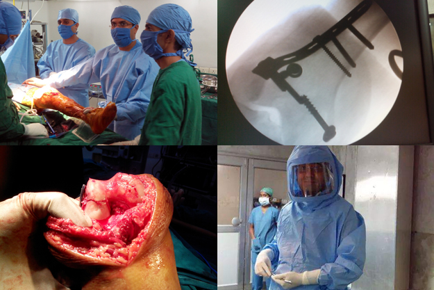 Dr. Mayur Purandare performing complicated surgeries